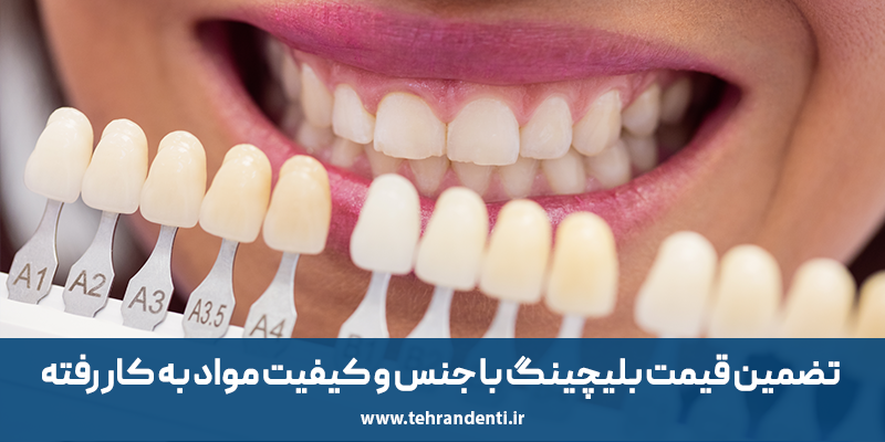 تضمین قیمت بلیچینگ با جنس و کیفیت مواد به کار رفته