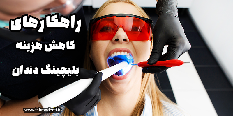 کاهش هزینه بلیچینگ دندان 