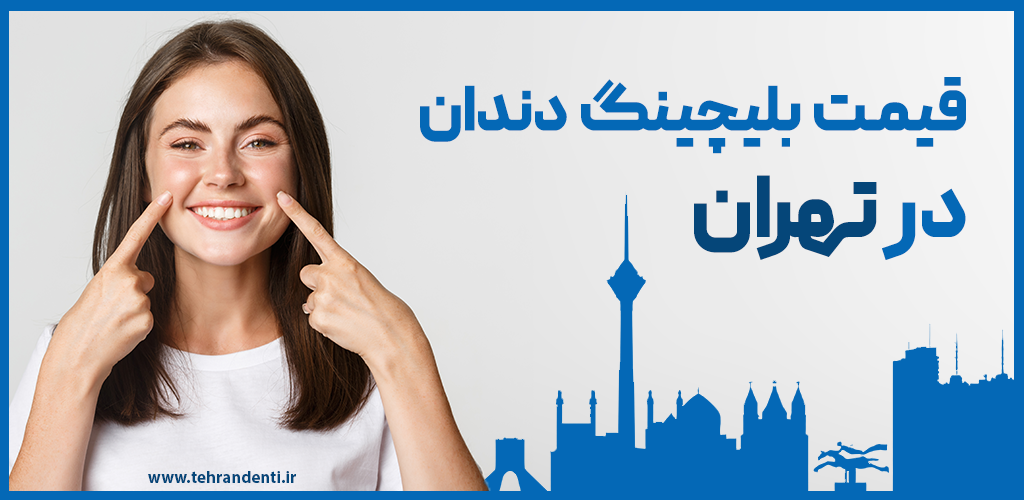 قیمت بلیچینگ دندان در تهران