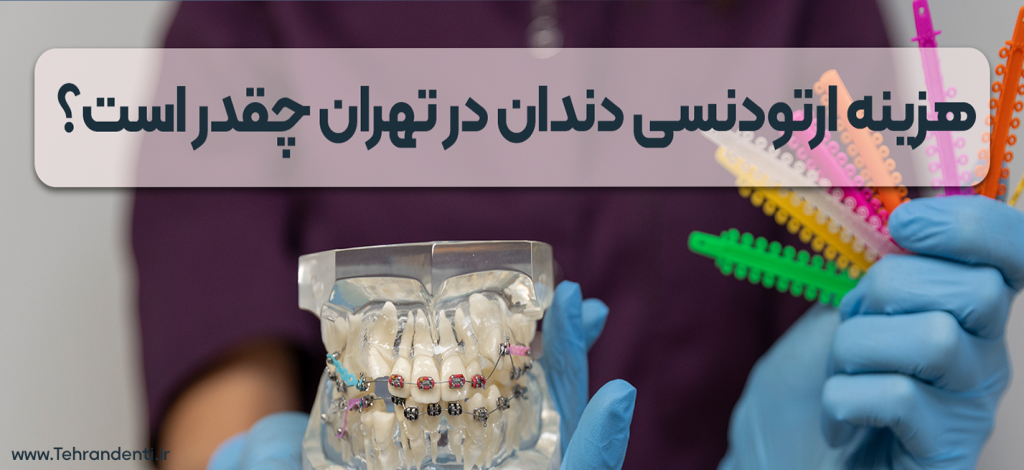 هزینه ارتودنسی تهران