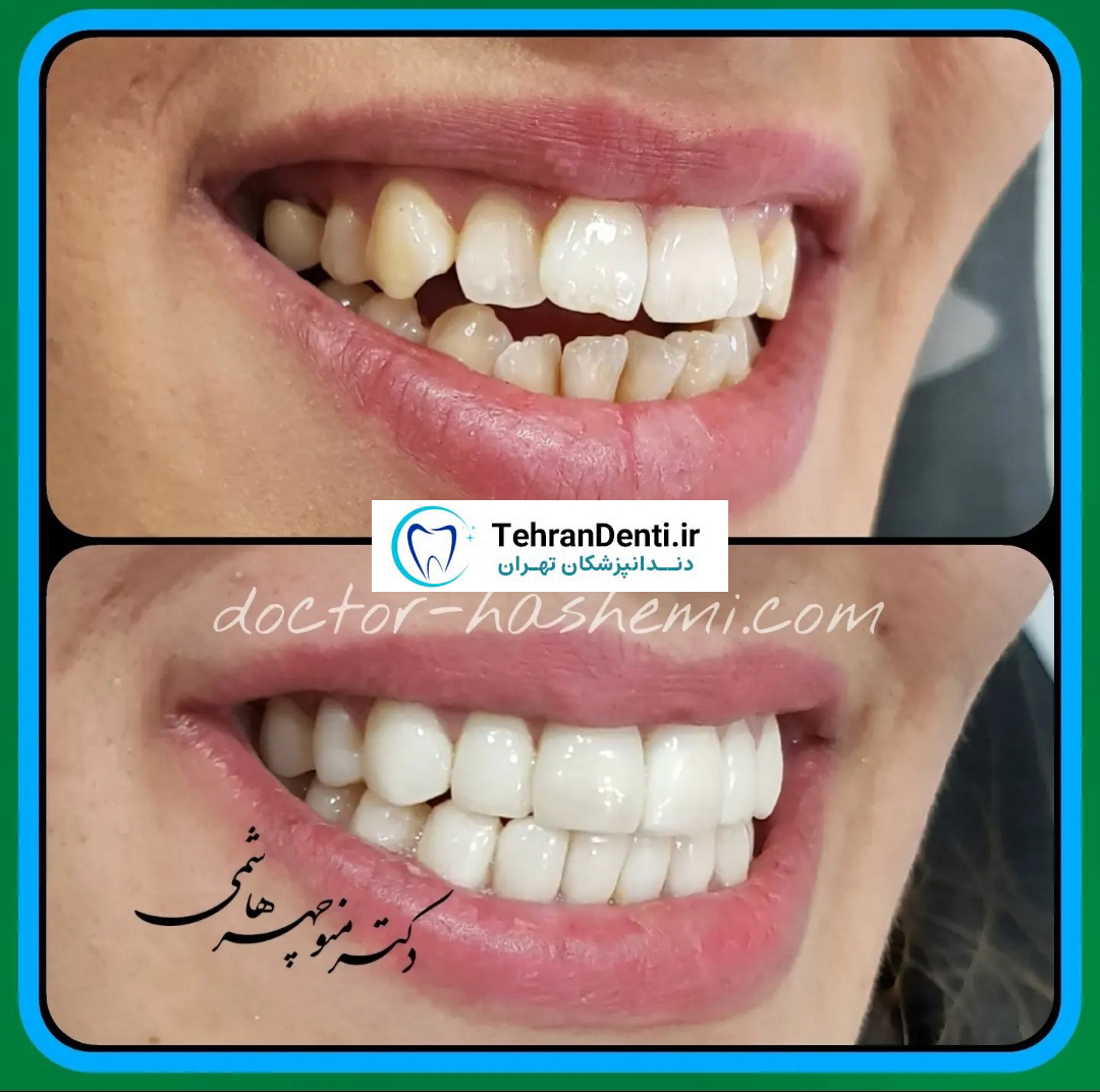 نمونه کاردکتر منوچهر هاشمی