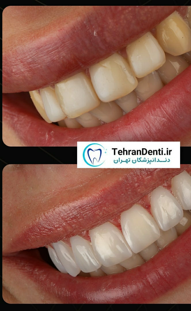 نمونه کار دکتر مانوشا امیری