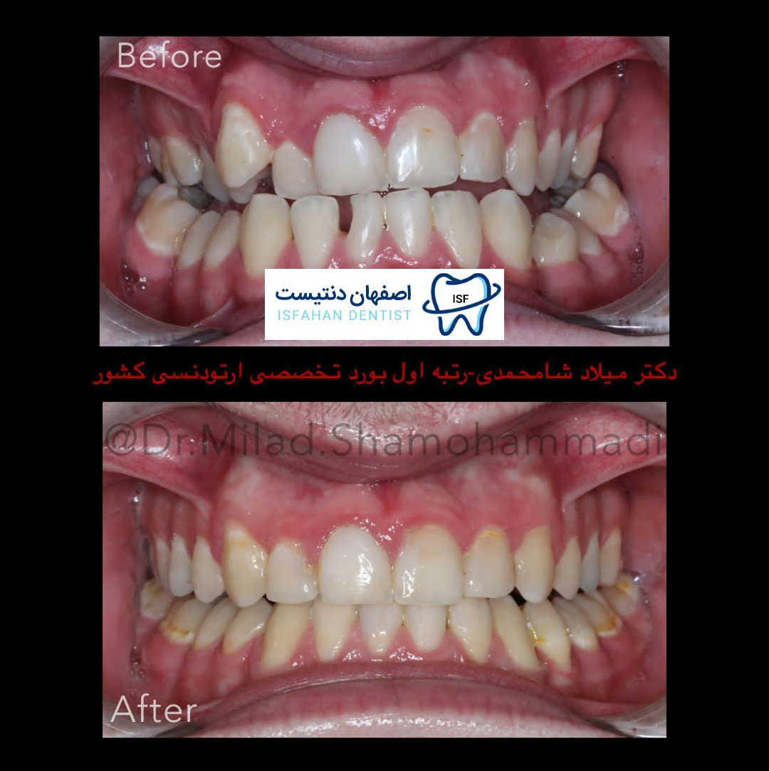 نمونه کار دکتر دندانپزشک میلاد شامحمدی