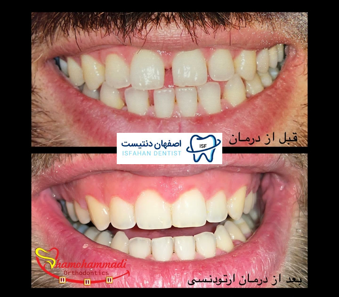 نمونه کار دکتر دندانپزشک میلاد شامحمدی