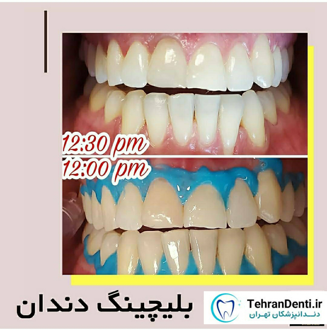 نمونه کار دکتر نازنین زینب گرشاسب زاده