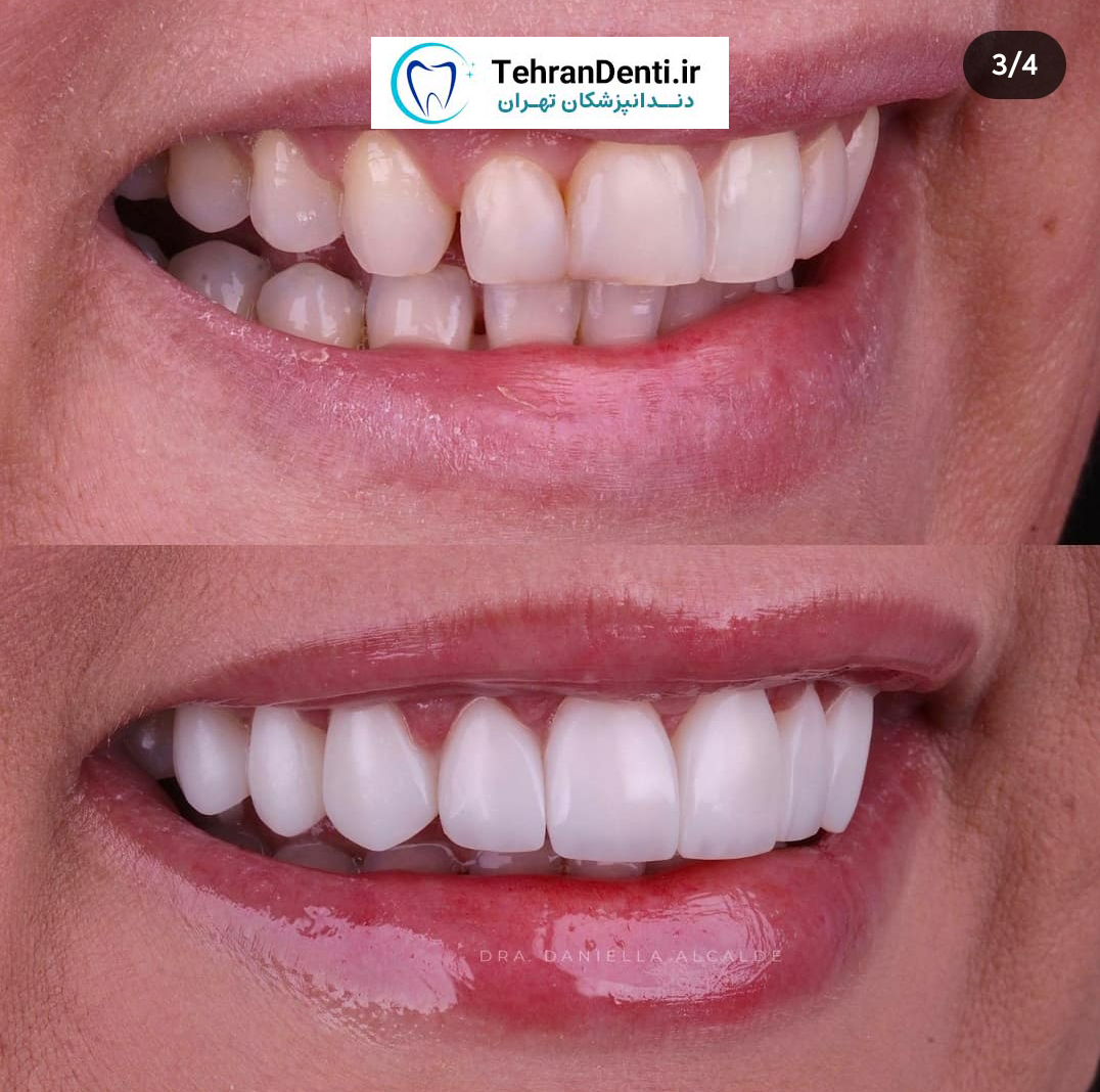 نمونه کار دکتر سعید کریمی