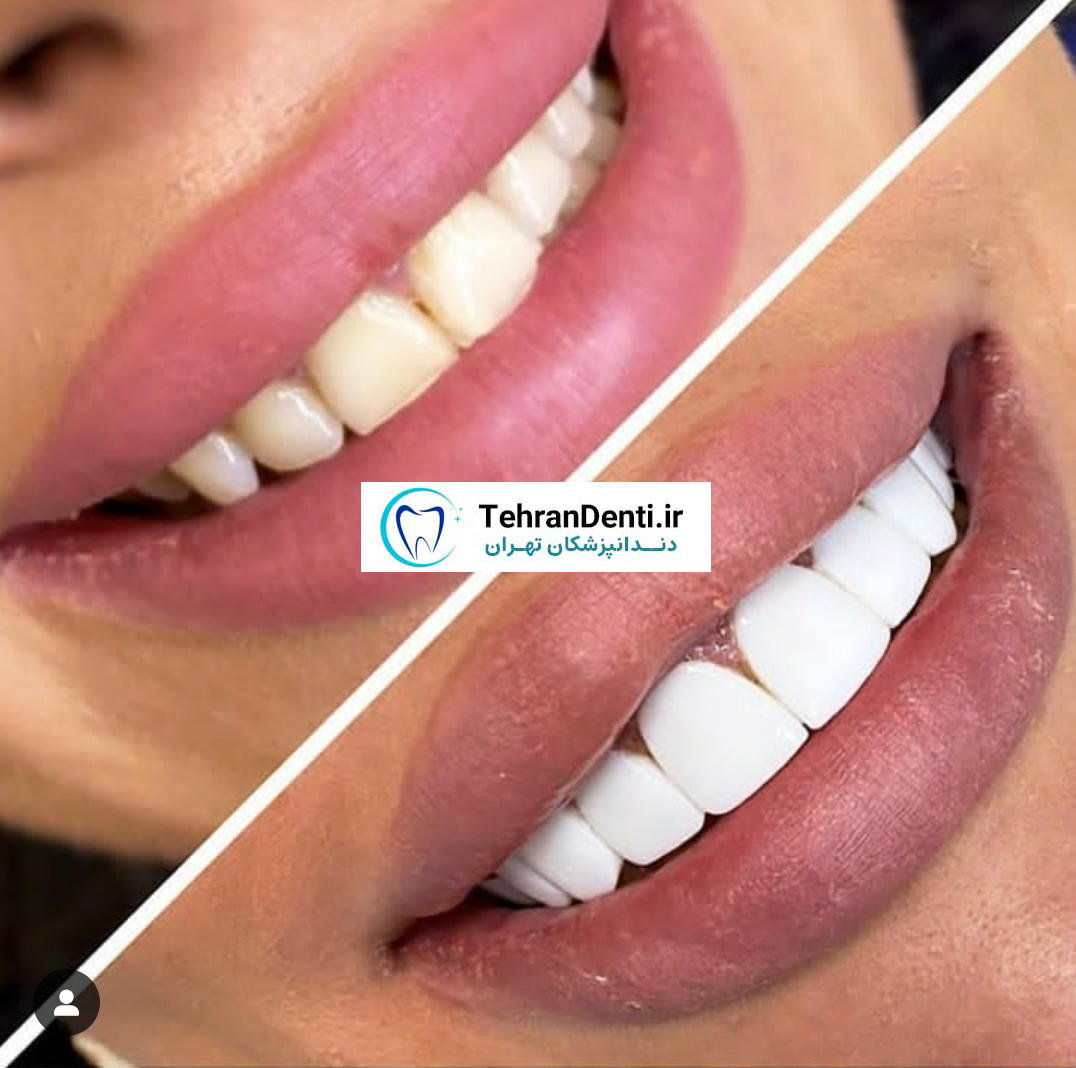 نمونه کار دکتر سعید کریمی