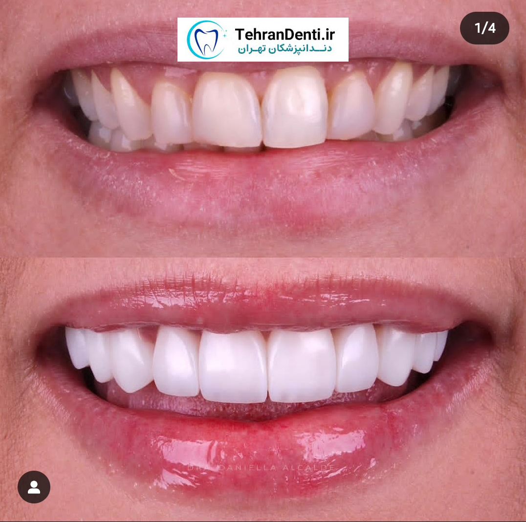 نمونه کار دکتر سعید کریمی
