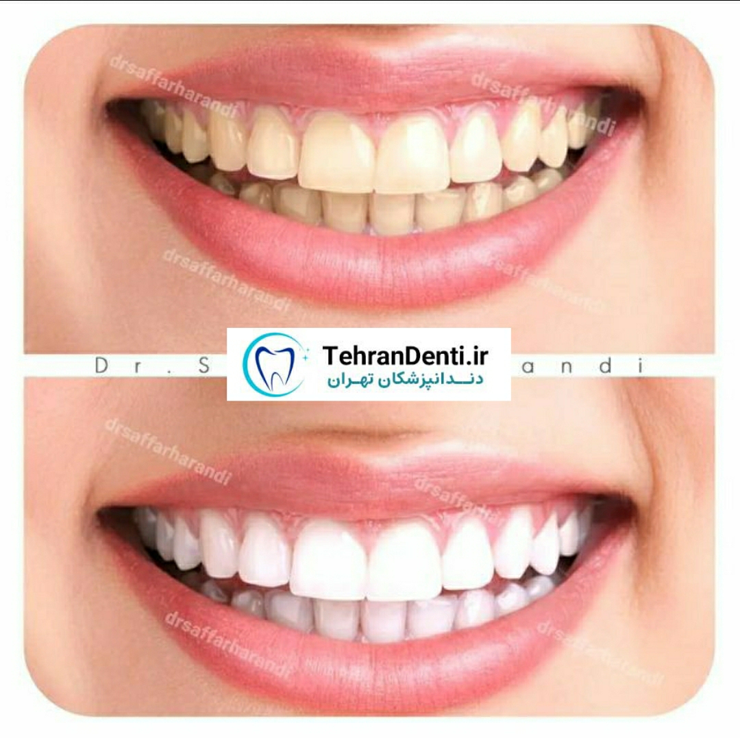 نمونه کار دکتر مجتبی صفار هرندی