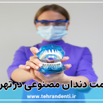 قیمت دندان مصنوعی در تهران
