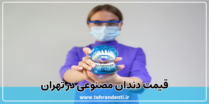قیمت دندان مصنوعی در تهران