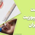 قیمت ونیر کامپوزیت در تهران